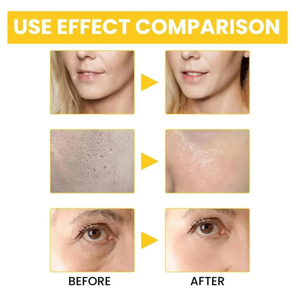 Sérum Anti-rides au rétinol, Anti-âge, Lifting du visage, raffermissant, estompe les ridules, soin hydratant pour la peau, acide hyaluronique